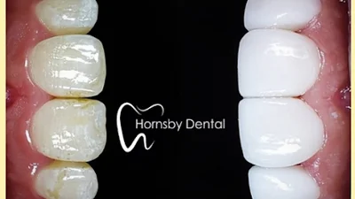 Hornsby Dental