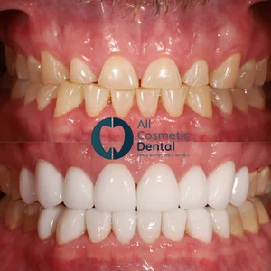 All Cosmetic Dental